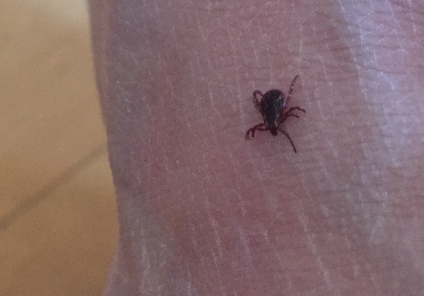 New 6 minute Plan To Remove Ticks From Clothes WTOP