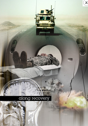 Soldier’s film focuses on traumatic brain injury