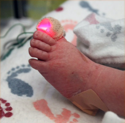 Pulse oximetry test: ‘ET’-like light could save babies