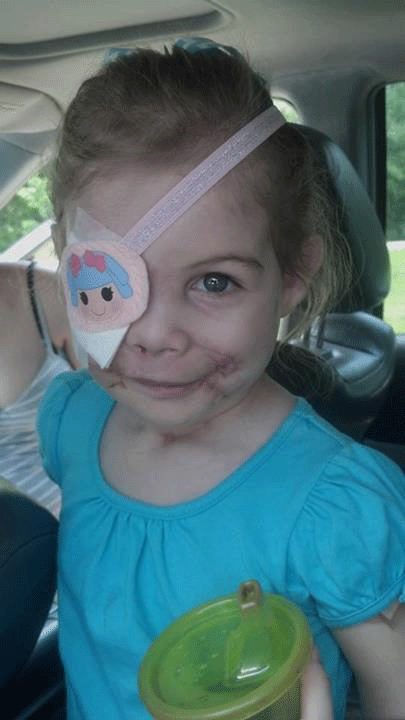 KFC: No proof worker asked scarred child to leave