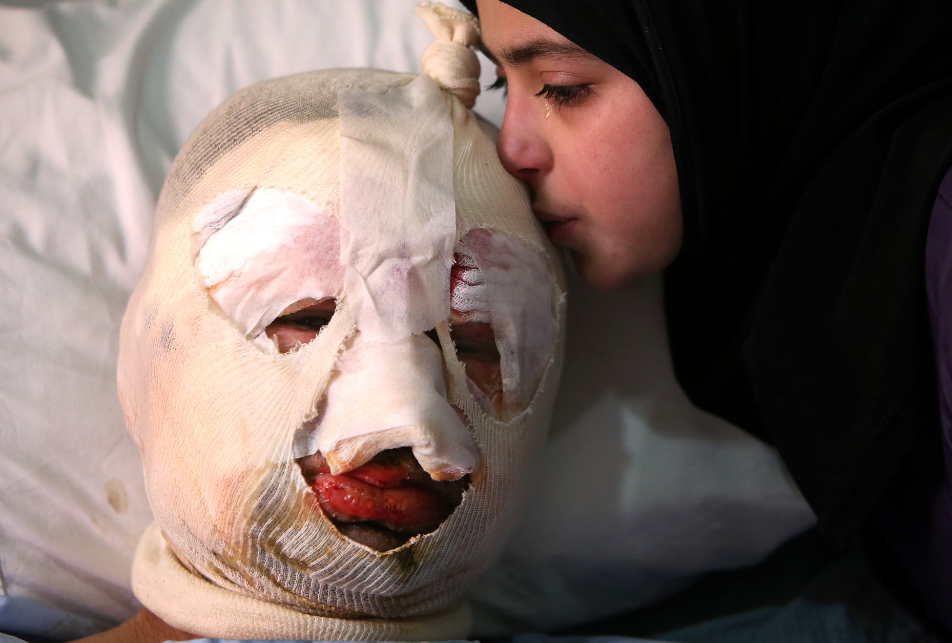 FOR USE AS DESIRED, YEAR END PHOTOS - FILE - Fatima, 13, weeps as she kisses her injured father, Ahmad al-Messmar, 40, who was wounded when a deadly car bomb blew up near a gas station, in the predominately Shiite town of Hermel, about 10 miles (16 kilometers) from the Syrian border in northeast Lebanon, Sunday, Feb. 2, 2014. A shadowy Lebanese Sunni extremist group claimed responsibility for a suicide car bombing in Hermel, a stronghold of Lebanon's militant Hezbollah group, that killed several people in the latest attack linked to the war in neighboring Syria. (AP Photo/Hussein Malla, File)