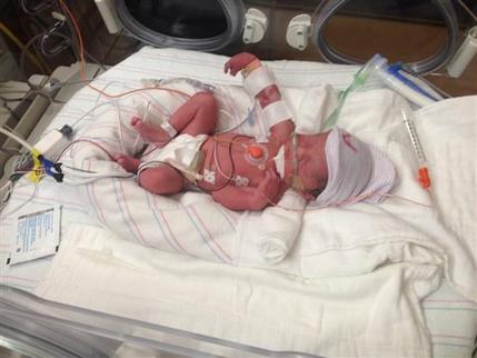 Phoenix woman dies after giving birth to quadruplets