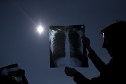 People use exposed X-ray films to observe a partial solar eclipse in Belgrade, Serbia, Friday, March 20, 2015. Astronomy lovers and sky gazers in Serbia were treated to a clear blue sky as they observed a partial solar eclipse in Belgrade on Friday. (AP Photo/Marko Drobnjakovic)