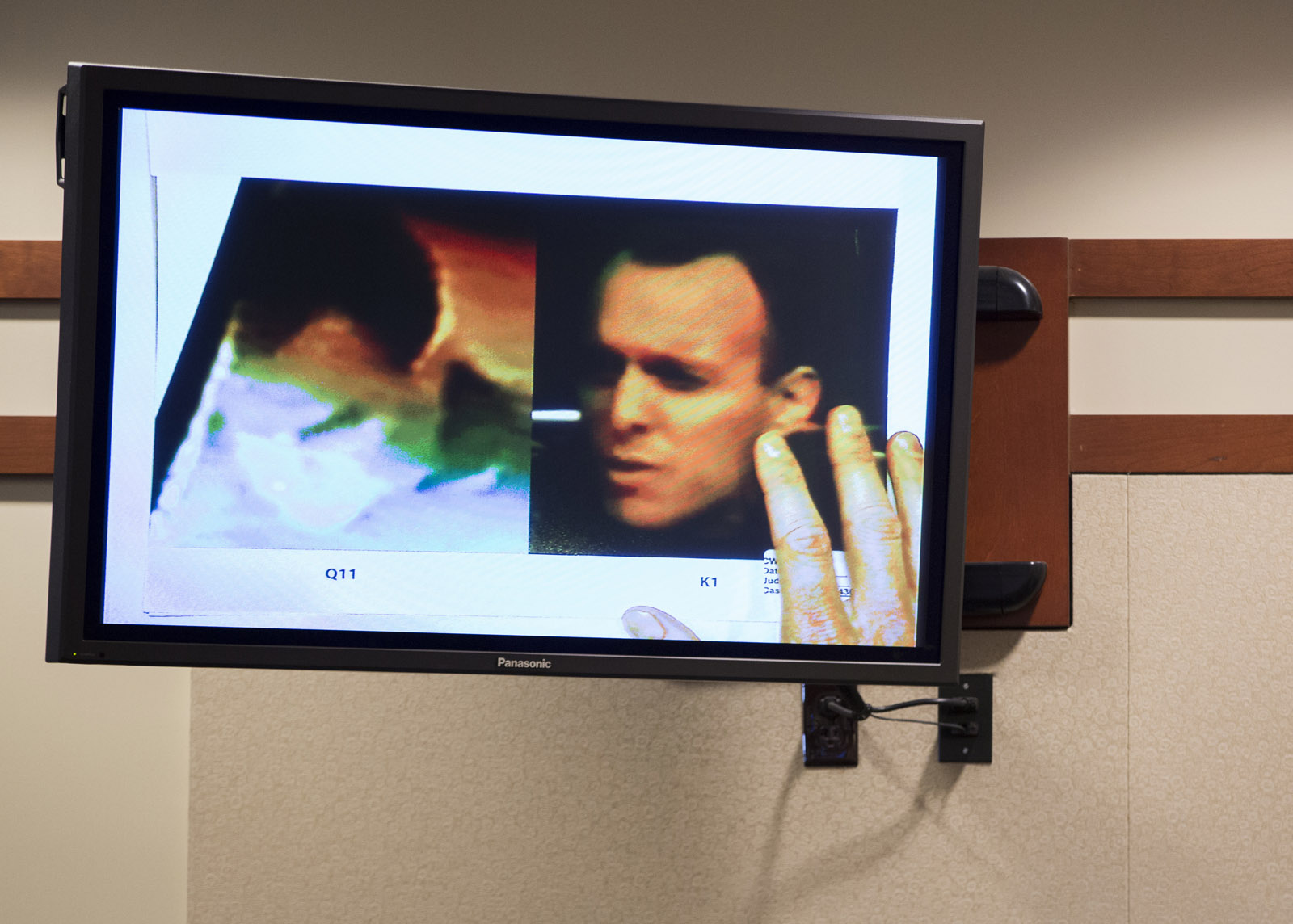 A photograph of Charles Severance, right, is shown next to an image of a man taken from surveillance video leaving a Target store the day Nancy Dunning was murdered, is shown on a monitor during a murder trial in Fairfax County Circuit Court on Friday, Oct. 16, 2015, in Fairfax, Va.  Severance is accused of three murders over the course of a decade in Alexandria, Va. (AP Photo/Evan Vucci, Pool)