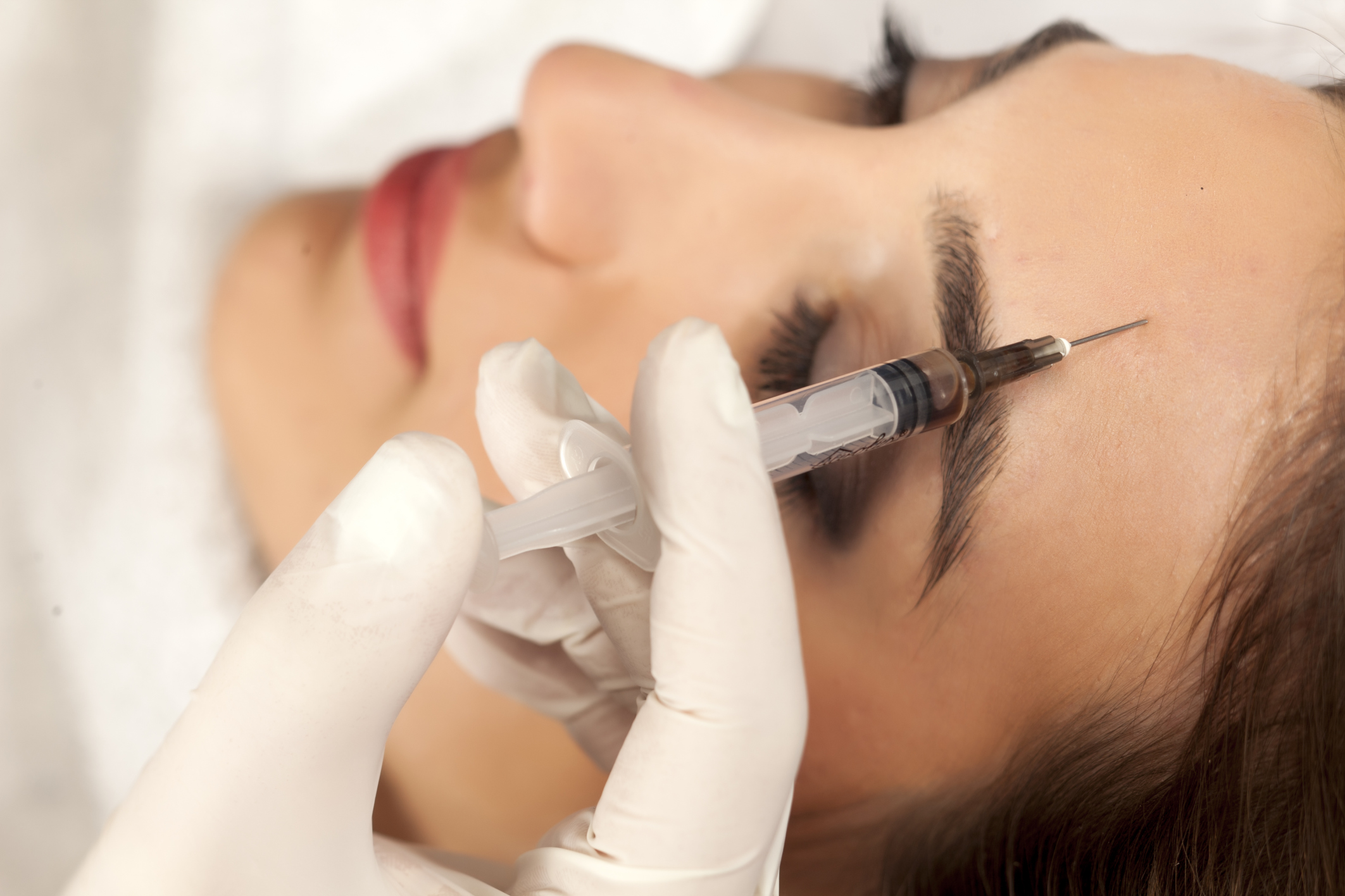 Why millennials are getting plastic surgery