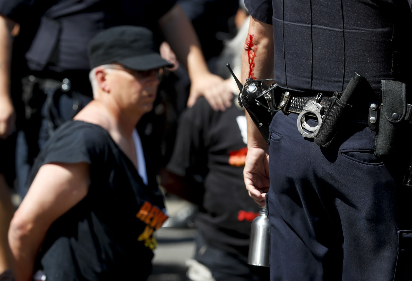 Blood runs down the arm of a police officer after a clash with protesters, Wednesday, July 20, 2016, in Cleveland, during the third day of the Republican convention. (AP Photo/John Minchillo)