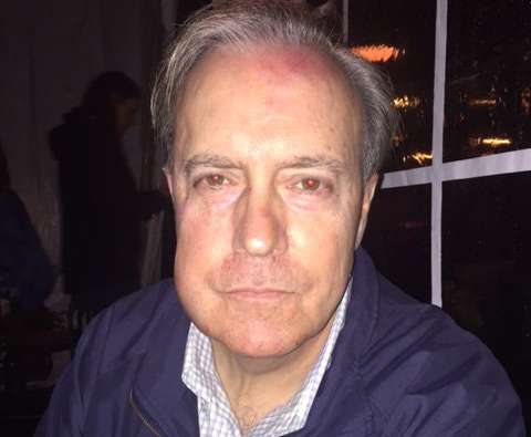 An attack Friday evening at Metro's Gallery Place platform left John Rowley, 62, with severe facial bruises and a broken hand. (Courtesy John Rowley)