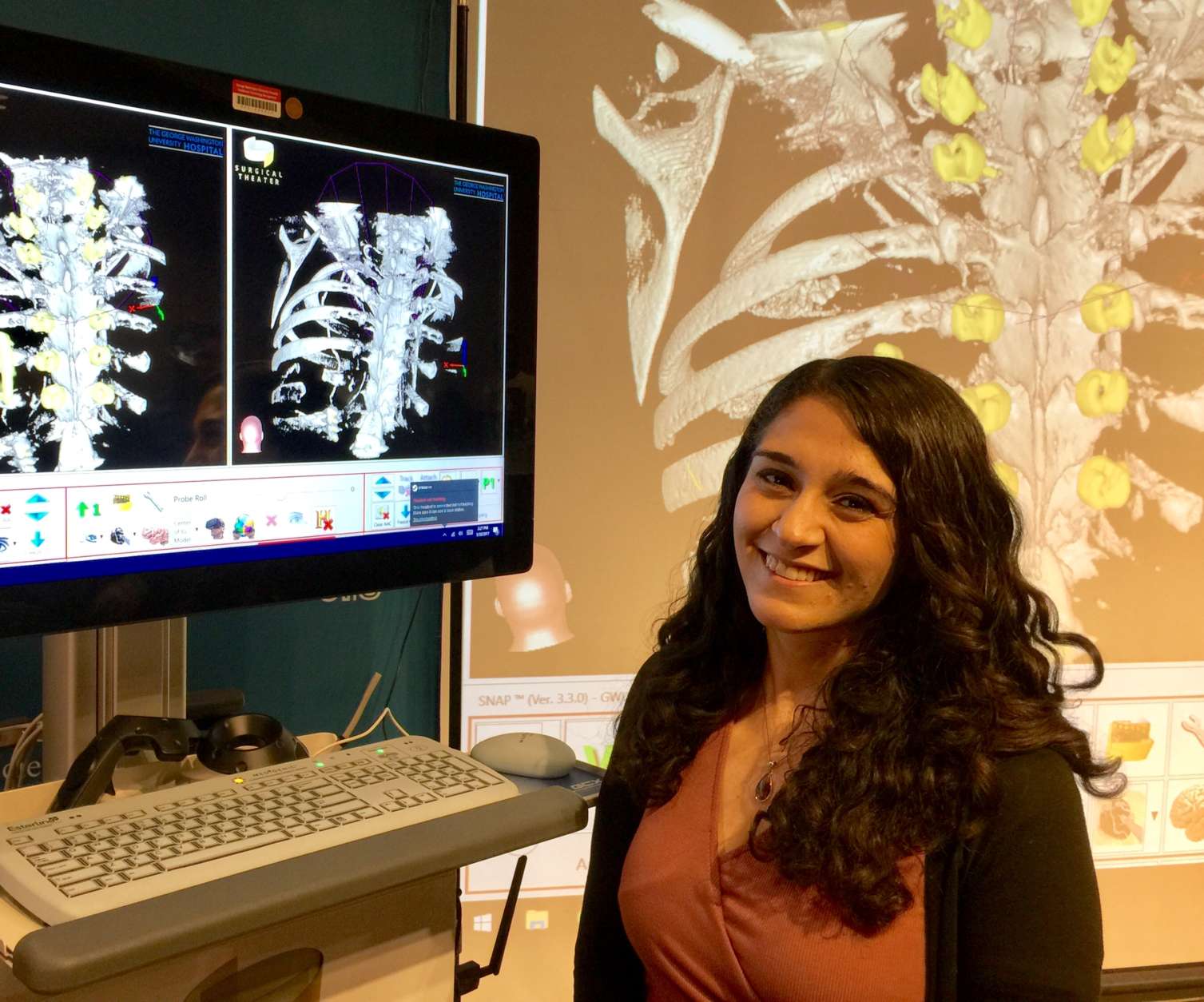 "It freaks me out to kind of look at it," former tumor patient Riz Chener said of examining the metal structure now holding a portion of her spine together. "I think it’s good to know, because, I mean, I feel certain parts of my body that are different." (WTOP/Kristi King)