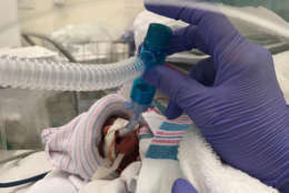  Ariana's weight dropped to 8 ounces shortly after her birth. (Courtesy Anne Arundel Medical Center) 