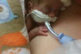  Ariana Sophia Cruz-Gutierrez weighed 12 ounces when she was born on March 9. (Courtesy Anne Arundel Medical Center) 