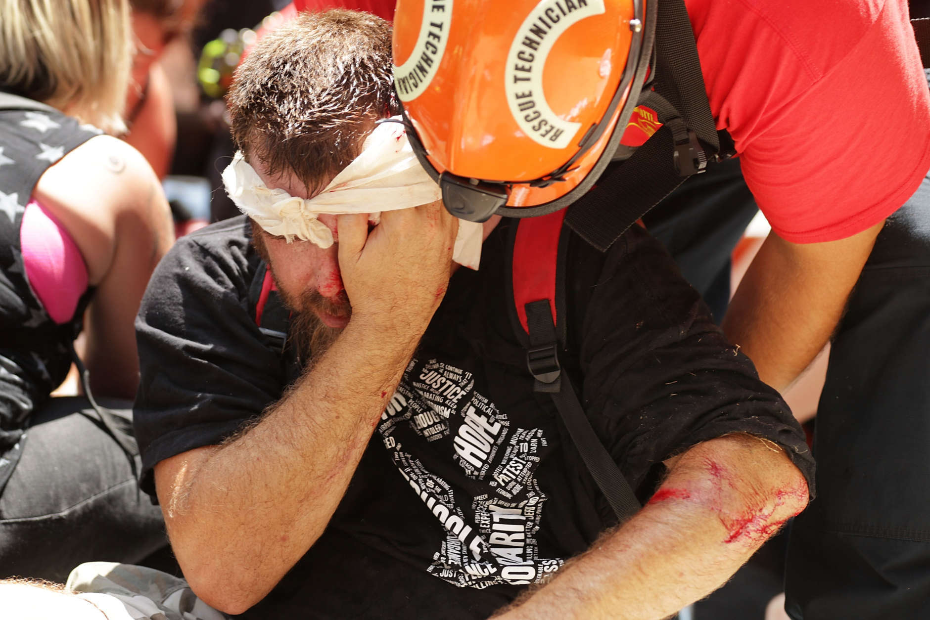 CHARLOTTESVILLE, VA - AUGUST 12:  Rescue workers and medics tend to many people who were injured when a car plowed through a crowd of anti-facist counter-demonstrators marching through the downtown shopping district August 12, 2017 in Charlottesville, Virginia. The car plowed through the crowed following the shutdown of the "Unite the Right" rally by police after white nationalists, neo-Nazis and members of the "alt-right" and counter-protesters clashed near Emancipation Park, where a statue of Confederate General Robert E. Lee is slated to be removed.  (Photo by Chip Somodevilla/Getty Images)