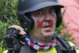 FILE-In this Saturday, Aug. 12, 2017 file photo, a white nationalist demonstrator, bloodied after a clash with a counter demonstrator, talks on the radio receiver at the entrance to Lee Park in Charlottesville, Va. How Virginia chooses to remember its past is still a highly combustible issue, as shown by the deadly violence that erupted at a white nationalist rally in Charlottesville last weekend over plans to remove a statue of Confederate Gen. Robert E. Lee.(AP Photo/Steve Helber, File)
