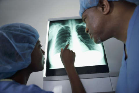 Women without risk factors twice as likely as men to be diagnosed with lung cancer