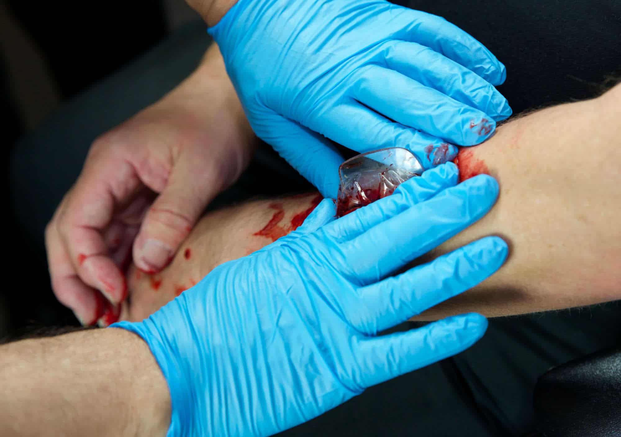 Witnessing trauma: how to stop the bleeding | WTOP