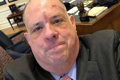 Md. Gov. Hogan touts successful skin cancer treatment