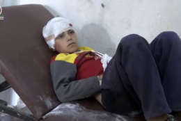 FILE - This Oct 26, 2016 frame grab from video provided by Muaz al-Shami, Syrian Revolution Network, an opposition activist media organization, shows a child in a hospital, after airstrikes killed over 20 people, in the rebel-held village of Hass, Syria. In 2018, after seven years of war in Syria, the United Nations has one thing to say: Stop the war on children. Of Syria’s estimated 10 million children, 8.6 million are now in dire need of assistance, nearly 6 million children are displaced or living as refugees and about 2.5 million are out of school. (Muaz al-Shami, Syrian Revolution Network, via AP, File)