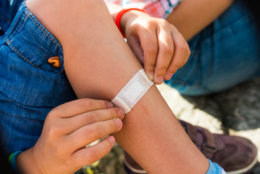 Child sticking plaster on leg - young tourist glued patch
