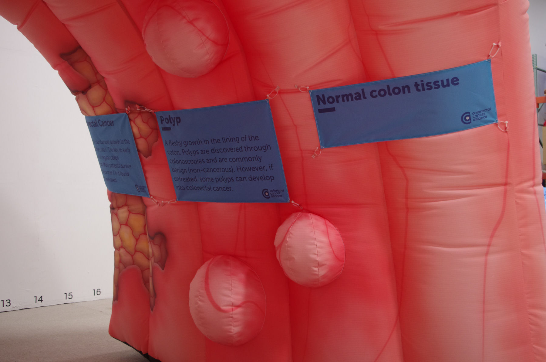 A giant inflatable colon will grace Freedom Plaza Friday, and visitors will be able to walk right through it. (Courtesy Spotted MP LLC)