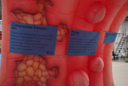 Colorectal cancer is the second leading cause of cancer-related deaths in men and women combined, according to the Colorectal Cancer Alliance. (Courtesy Spotted MP LLC)