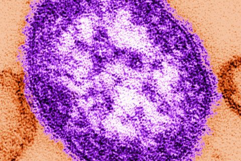 Virginia investigates possible measles exposure at Dulles, Inova