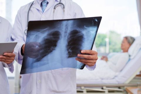 ‘Close doesn’t count:’ Biomarker testing crucial for modern lung cancer treatment