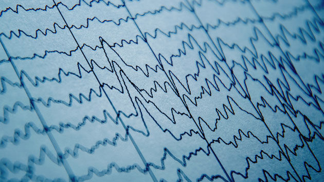 U.Va. researchers think they know why some with autism struggle to communicate