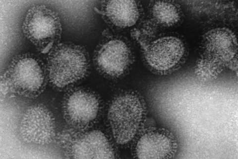 Maryland among 2 states where flu is widespread