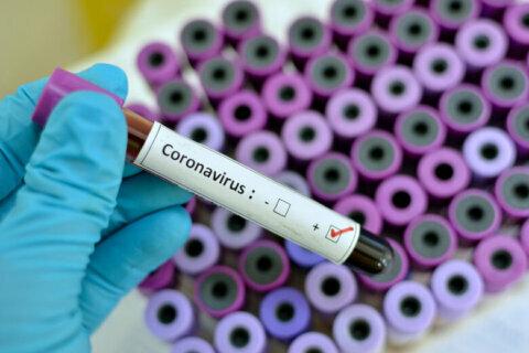 Sick passenger at BWI didn’t meet coronavirus testing criteria
