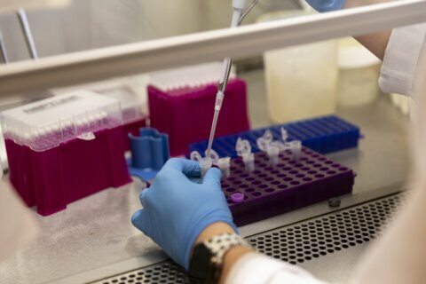 Coronavirus symptoms can last much longer than initially thought, experts say