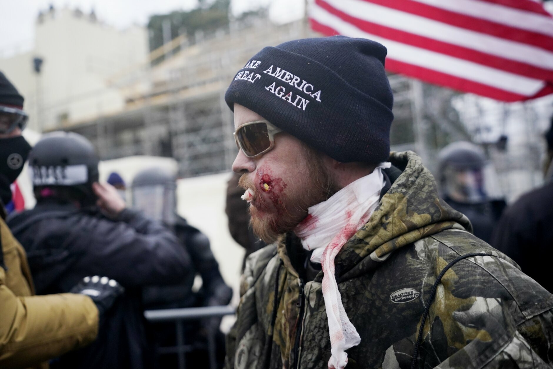 A protester is shown injured during a confrontation with police during a rally Wednesday, Jan. 6, 2021, at the Capitol in Washington. As Congress prepares to affirm President-elect Joe Biden's victory, thousands of people have gathered to show their support for President Donald Trump and his claims of election fraud. (AP Photo/Julio Cortez)