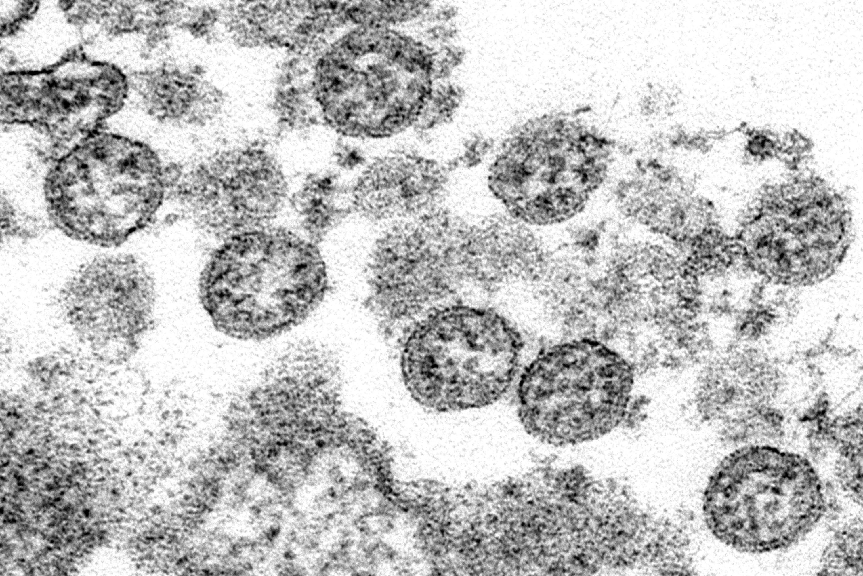 Un nuevo estudio muestra que el este de Asia se vio afectado por otra epidemia del virus Corona hace 20.000 años.