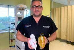 Dr. Samer Elbabaa, a pediatric neurosurgeon at Orlando Health Arnold Palmer Hospital for Children, holds 3D printed models of fetuses. The models allow surgeons to review, visualize and prepare for a complex procedure normally supported only by MRI and ultrasound imaging.