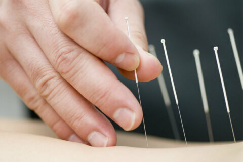 Seeking pain relief through acupuncture increasingly popular, DC-area consumer group finds