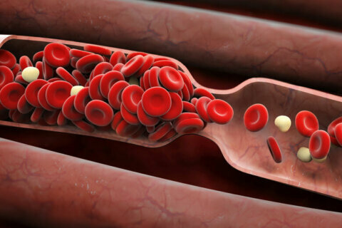 What are warning signs of blood clots?
