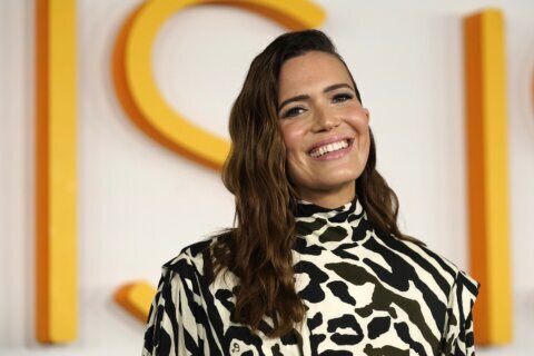 Mandy Moore says her son has rare skin condition