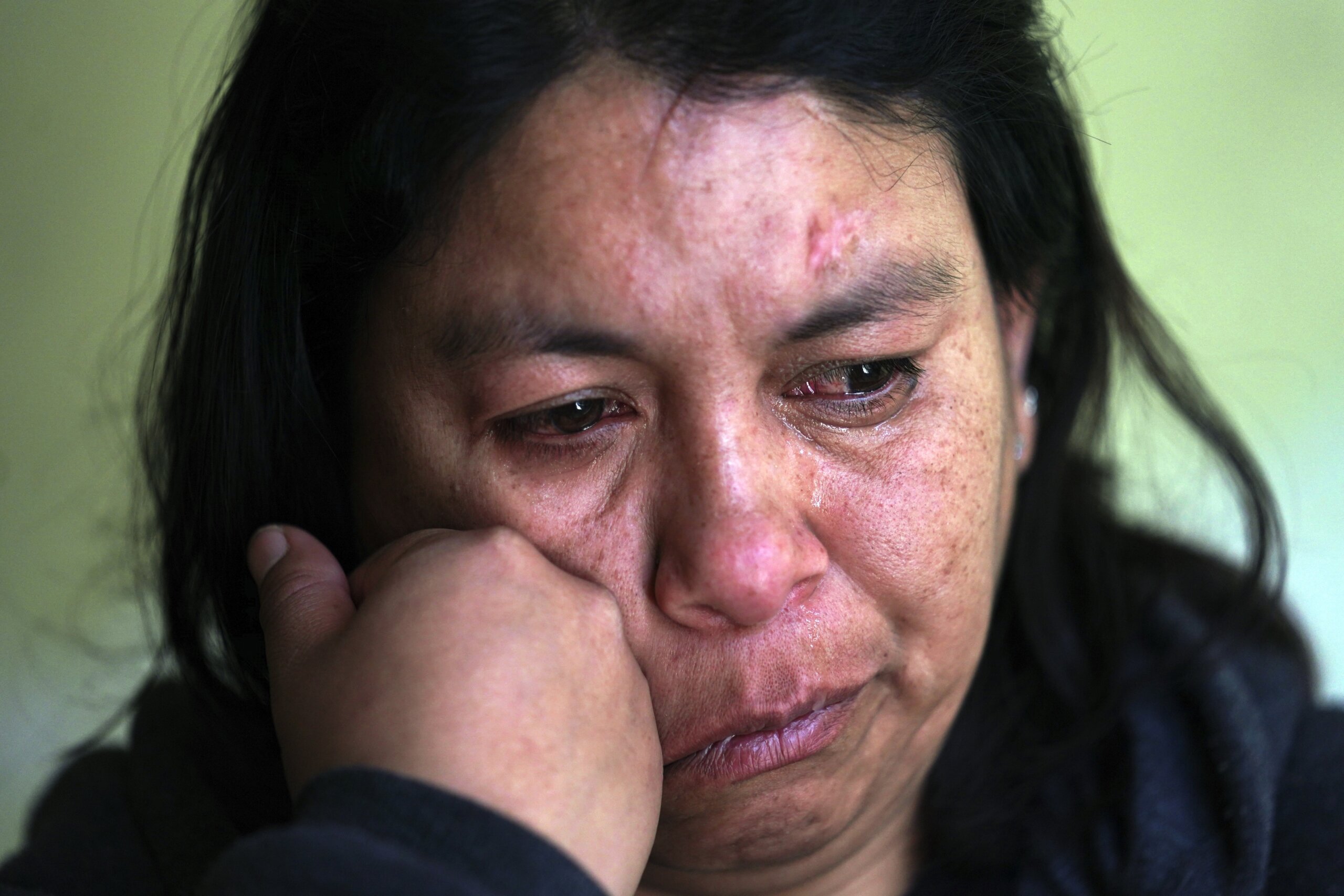 Mexican Woman Shot In Head By Us Border Patrol Files Claim Wtop News 3880
