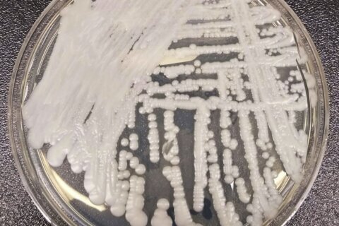 1st for Louisiana: Drug-resistant fungus found at hospital