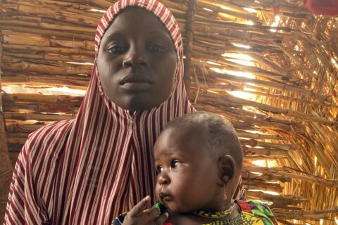 Child malnutrition mounts amid conflict in northeast Nigeria
