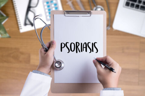 People suffering from psoriasis are more at risk of depression