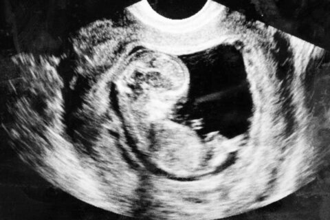 En año electoral, Trump pide a republicanos ser “flexibles” sobre restricciones al aborto