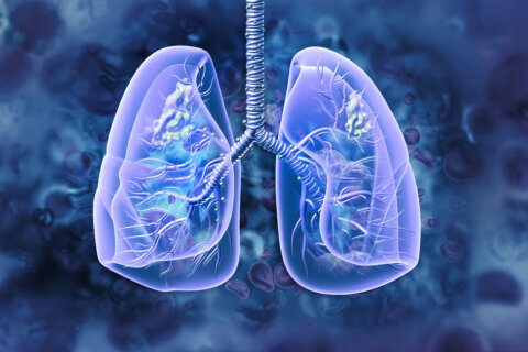 Lung cancer: Risk factors, symptoms and treatment