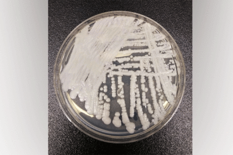 Health care officials tracking nationally spreading deadly fungus in DC region