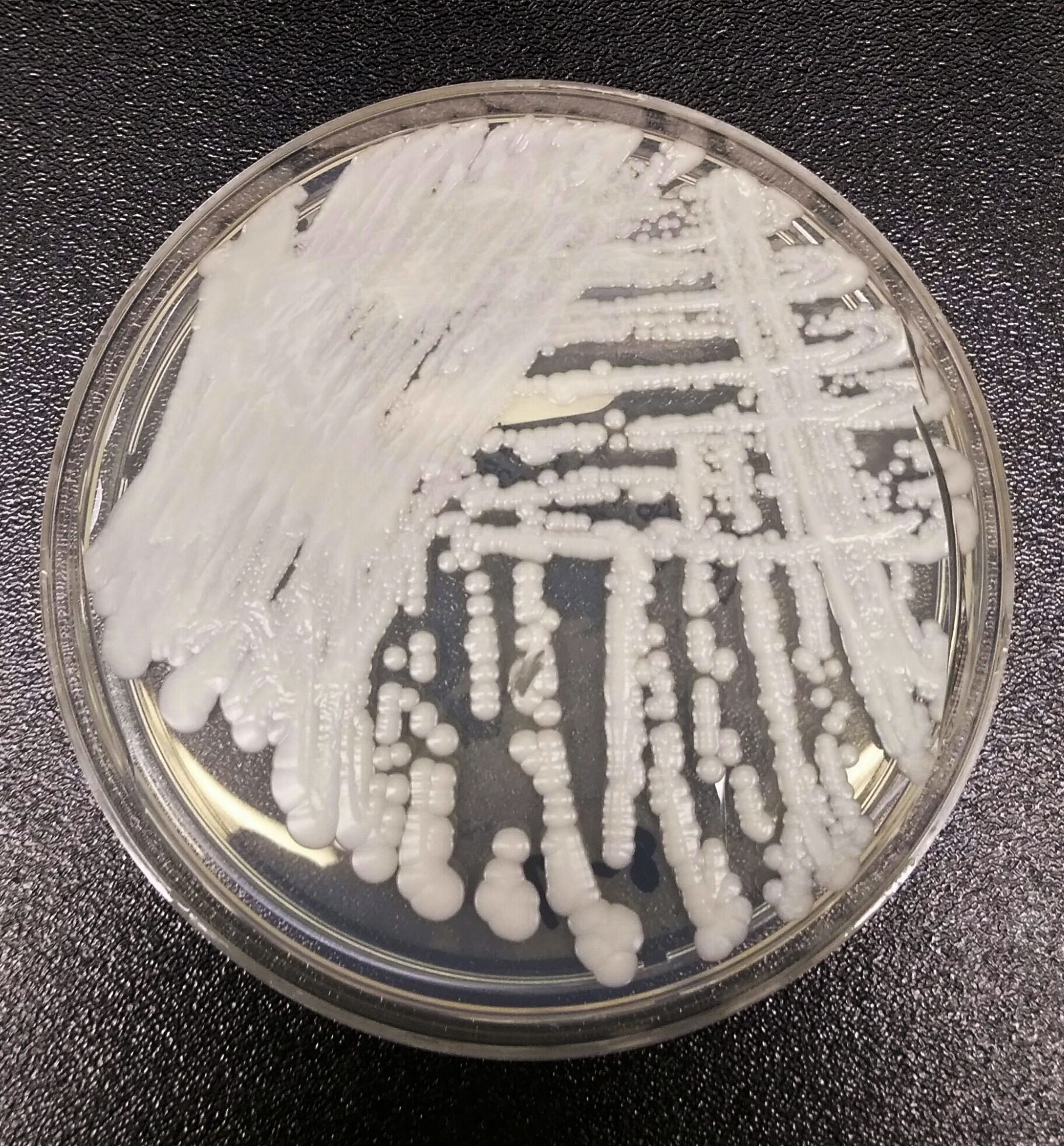 Health care officials tracking nationally spreading deadly fungus in DC, Md. and Va. – WTOP News