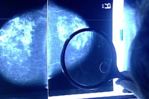 UVA researchers say new findings offer hope to keep breast cancer from spreading