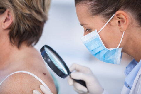 Melanoma Monday: DC-area dermatologist shares tips on skin cancer prevention, sun safety