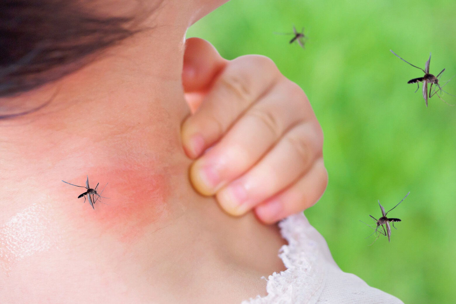 anopheles mosquito bite