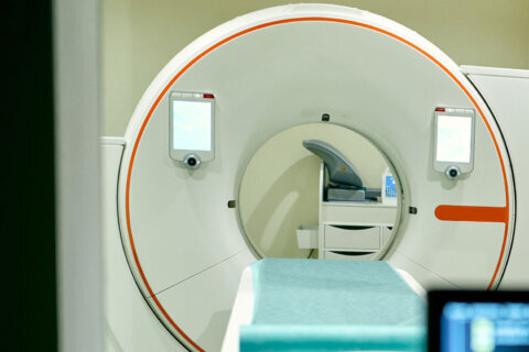 WTOP’s Neal Augenstein: Brain MRIs in my future for lung cancer recovery