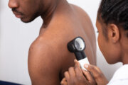 Close-up Of A Female Doctor Checking Pigment Skin On Man's Back With Dermatoscope