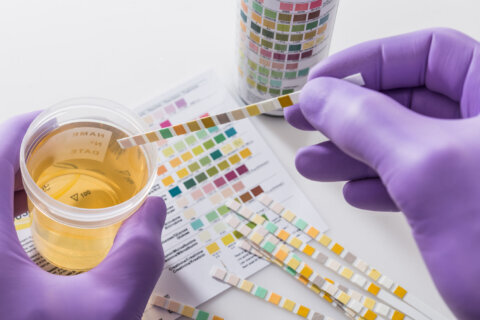 Why is urine yellow? University of Maryland researchers discovered the answer