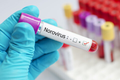 Norovirus illnesses are up in some places. Here’s what you need to know